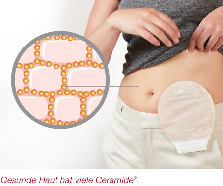 Ostomy Barrier